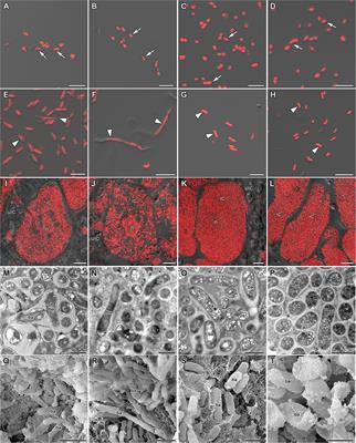 Tubulin Cytoskeleton Organization in Cells of Determinate Nodules